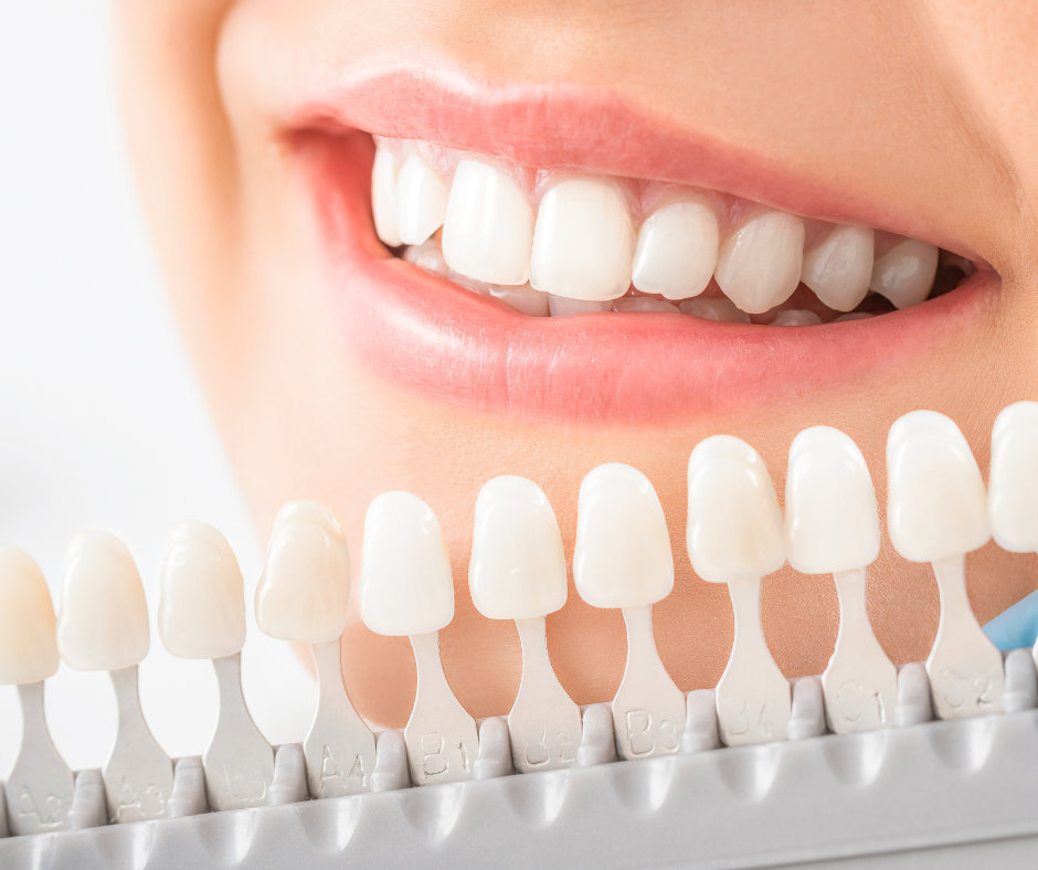 Why Kids Shouldn’t Use Whitening Products (Yet)