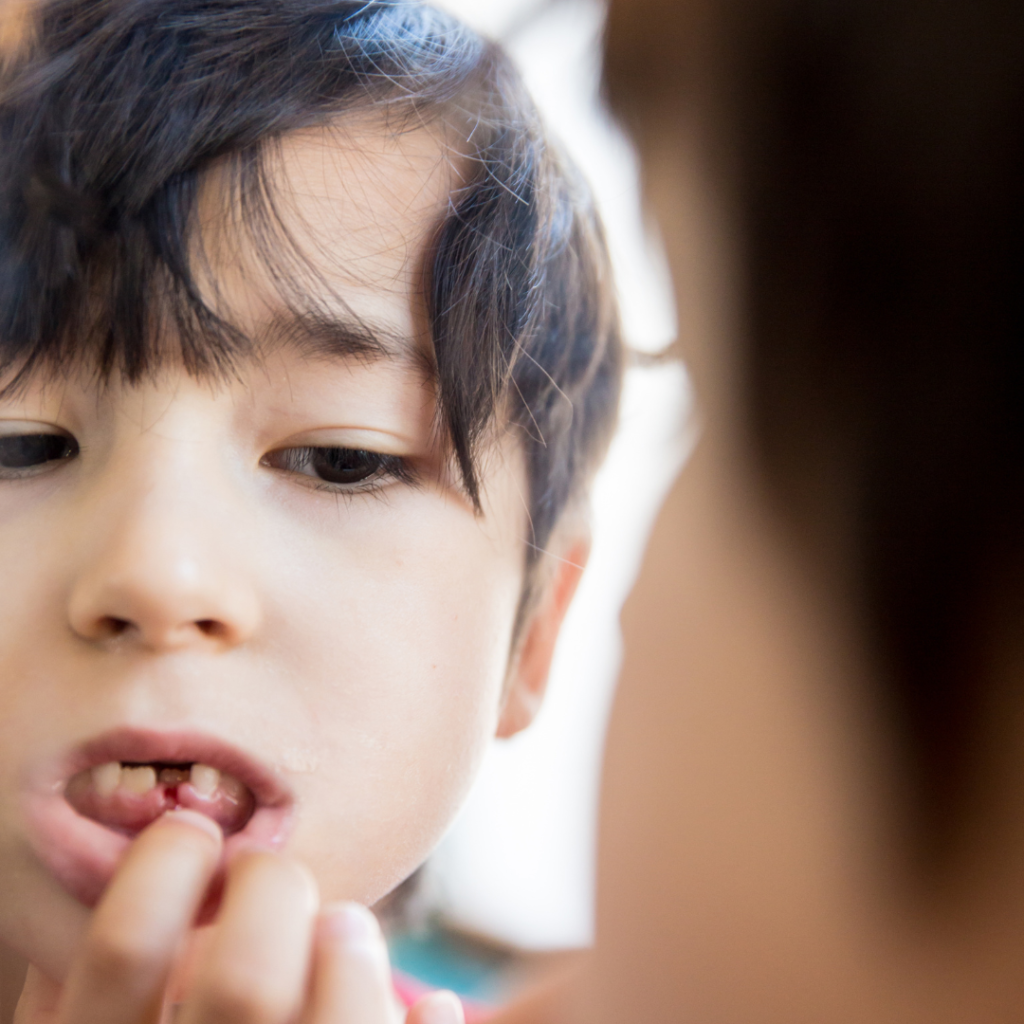 When Should My Child’s Baby Teeth Fall Out — and When Should I Worry?